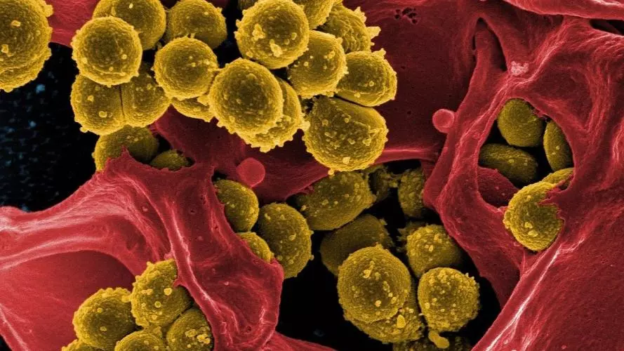 Microscope image of yellow bacteria on red background
